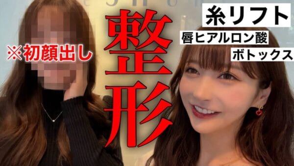 大人気美容系YouTuber・Rちゃん、更なる整形で、ぷるぷる唇に！視聴者から「唇マジで可愛い」と絶賛の声！