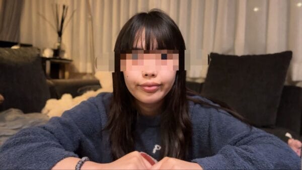 「整形は100％じゃない！！」ヒヨごん、整形後のダウンタイム姿を公開した動画に視聴者からの共感や応援の声