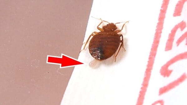 おーちゃんねる、トコジラミをネットカフェで確保!?「お尻に粒みたいなのあるけど」と卵を発見し、「やりましたー！」と喜ぶ