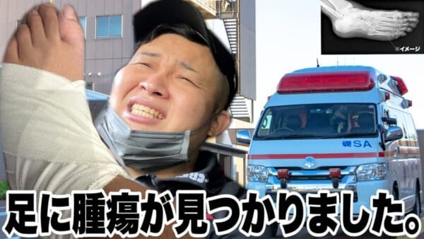 フィッシャーズ・ンダホ、足首を捻って検査するとかかとに腫瘍が!?「びっくり」と想定外の事態に驚き　視聴者からは「お大事に」と心配の声